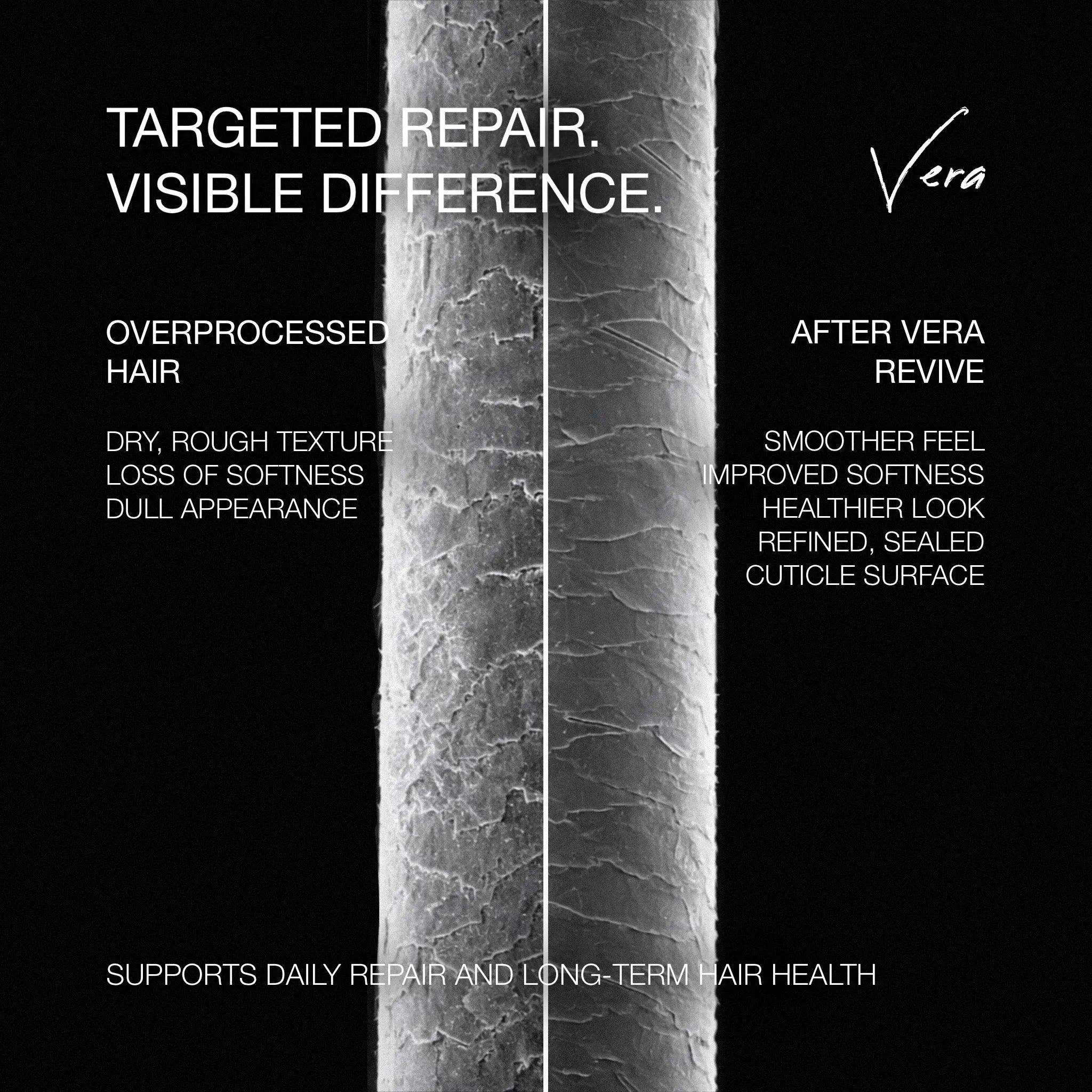 Vera™ Revive Set